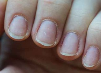 How to treat fragile nails?