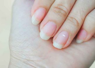 What are white spots on nails and what do they look like?
