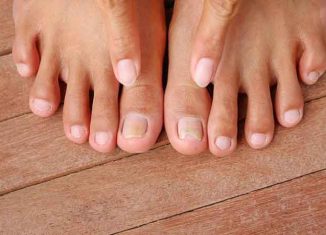 Ingrown toenail: how to relieve pain?