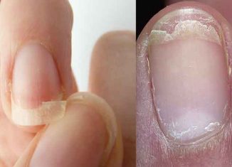 Tips to Stop Nails Splitting